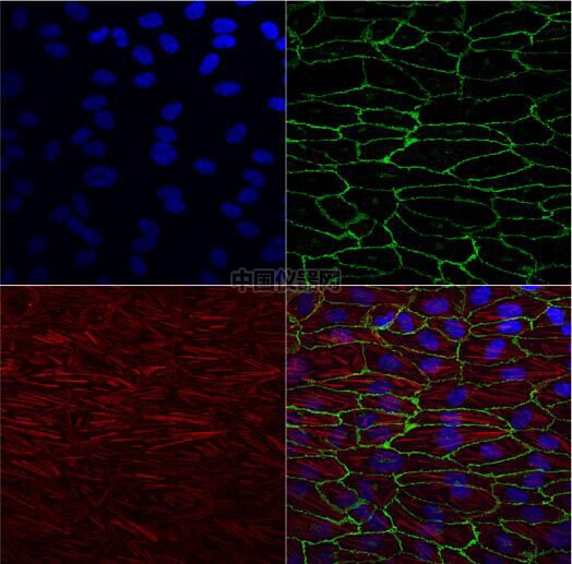 流體剪切力實驗：流體環(huán)境下的HUVEC細(xì)胞培養(yǎng)，真實還原體內(nèi)環(huán)境