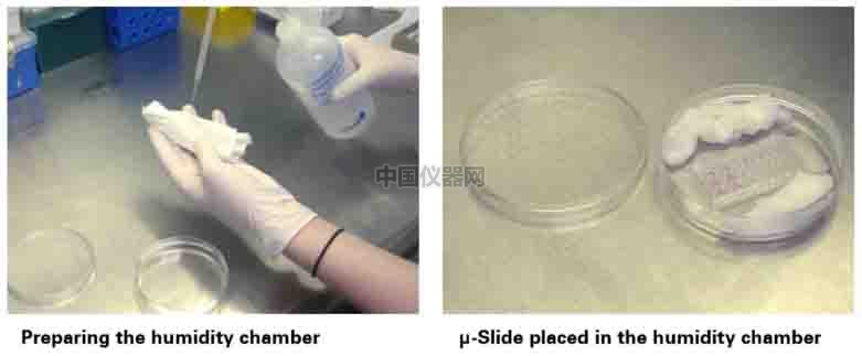 血管生成--甲狀腺轉錄因子-1（TTG-1）影響肺癌細胞血管生成